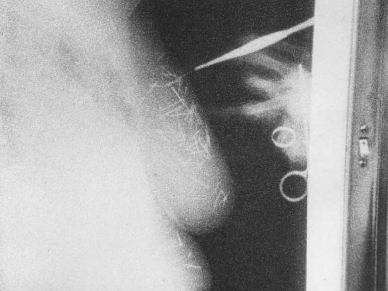 Röntgenaufnahme der Doña Lucretia mit vielen eingebetteten Nadeln