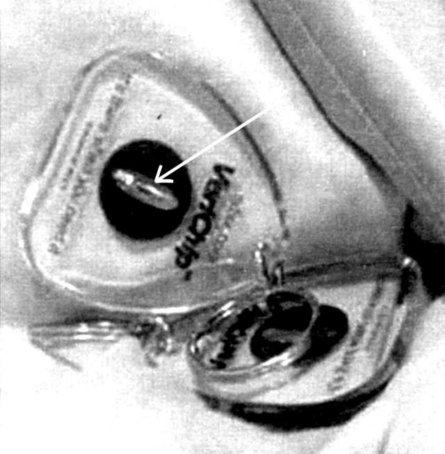 Schlüsselanhänger mit Transponder  (Detail)